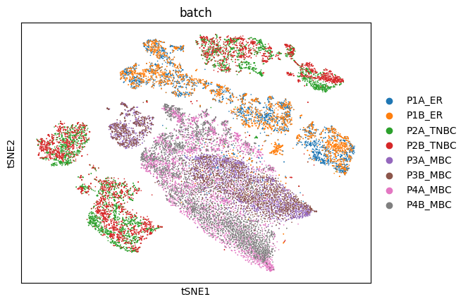Toyin's Data Science Projects t-SNE illustrating the spatial organisation of cells within a cancerous tissue